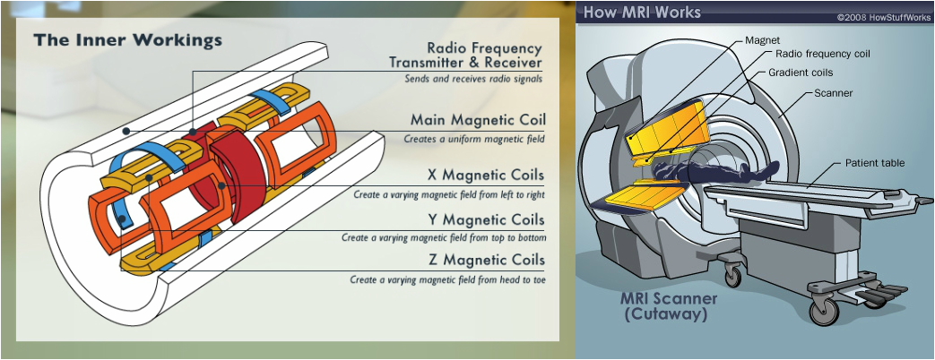 How does an MRI work?